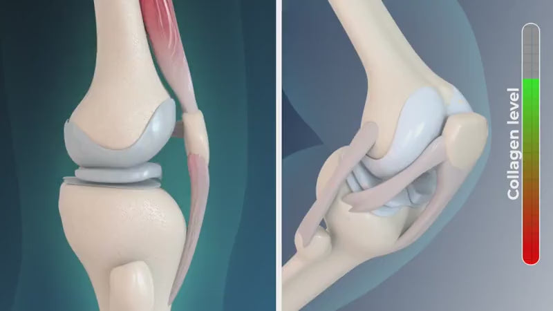non-invasive treatments for arthritis knee pain. how to stop knee pain naturally. knee excercizes at home. stop knee pain with Gladiora knee massager